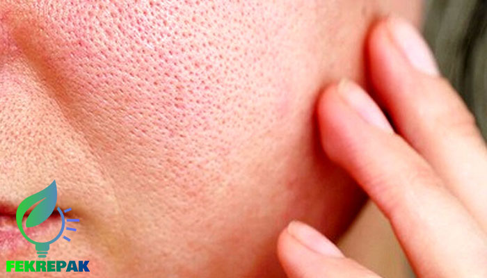 ماسک صورت خانگی برای پوست چرب