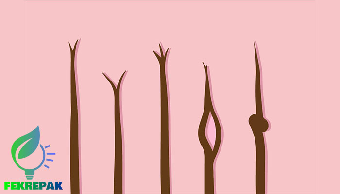 درمان مو خوره