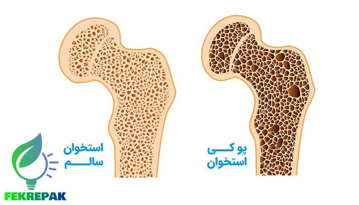 خواص سرکه سیب