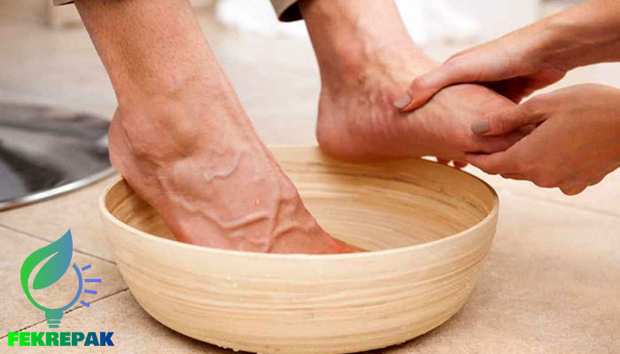 خواص سرکه سیب