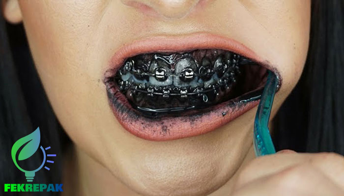 مزایا و معایب خمیر دندان زغالی برای سفید کردن دندان