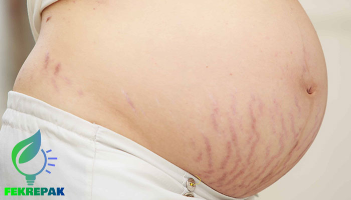 تغییرات پوست در دوران بارداری