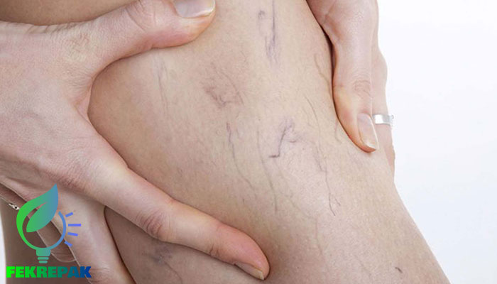 تغییرات پوست در دوران بارداری